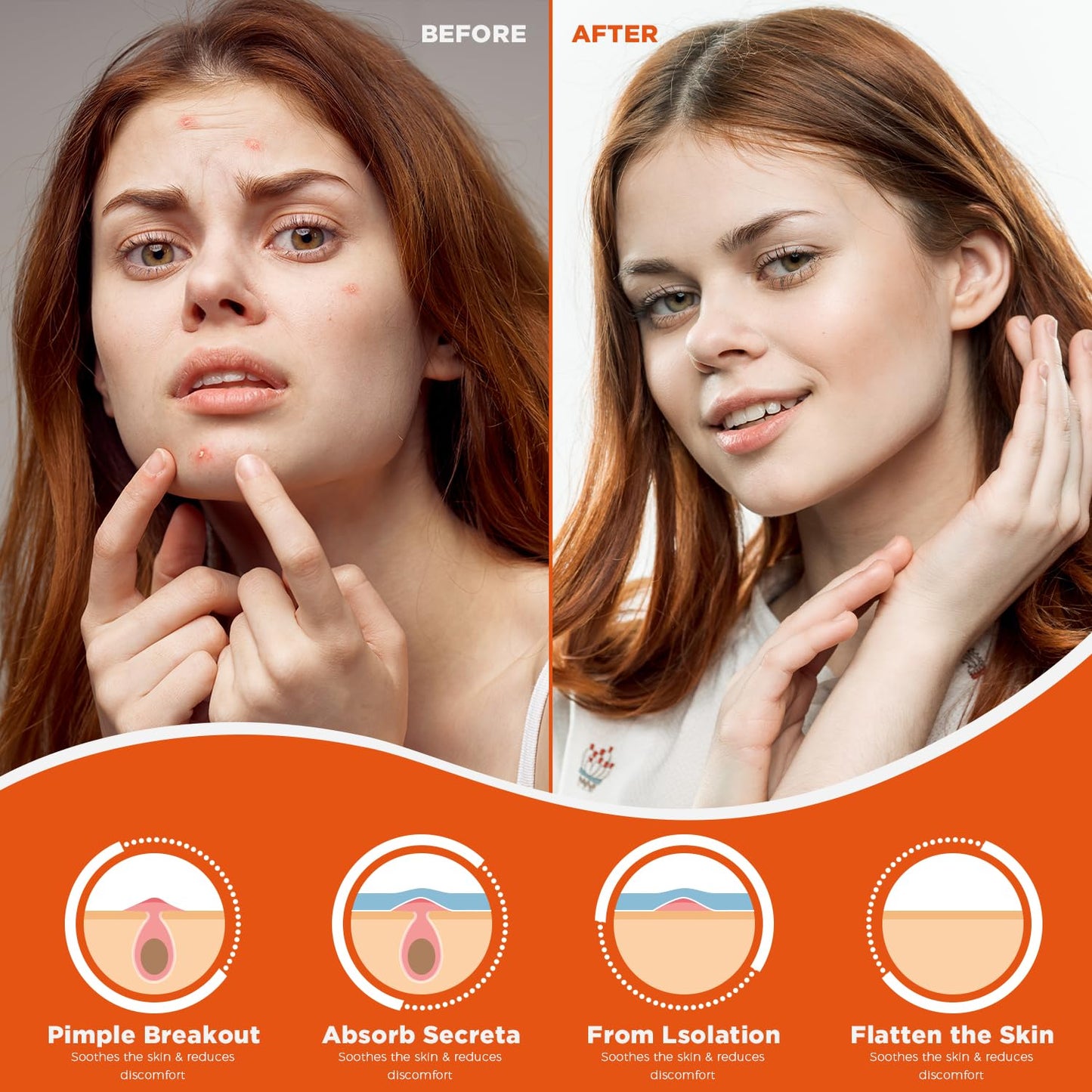 Advanced Hydrocolloid Acne Pimple Patches (60 Count) - Fast-Acting Spot Treatment for Blemishes and Breakouts | Vegan & Cruelty-Free Skin Care Solution